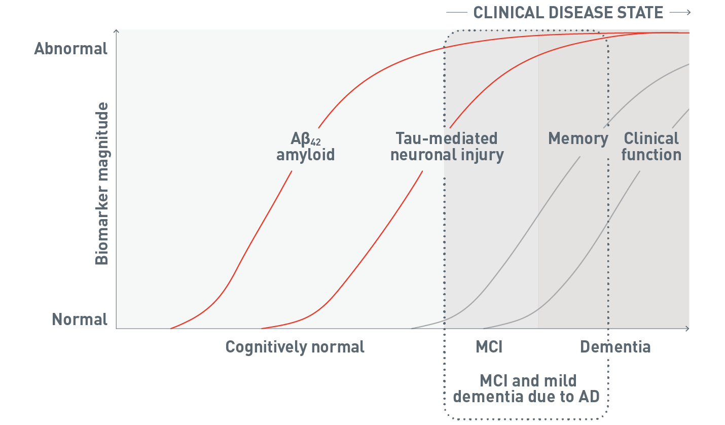 Chart showing Alzheimer's disease pathology over the disease continuum